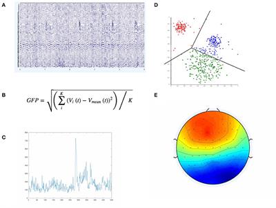 Modeling Uncertainties in EEG Microstates: Analysis of Real and Imagined Motor Movements Using Probabilistic Clustering-Driven Training of Probabilistic Neural Networks